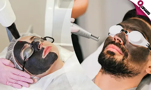 Carbon Laser for Face, Hair & Dark Areas!